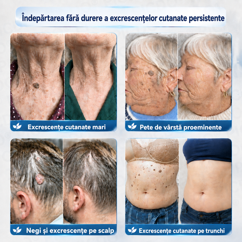ELAVYRA® cremă pentru îngrijire locală – imagine 2