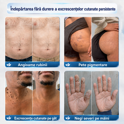 ELAVYRA® cremă pentru îngrijire locală – imagine 3