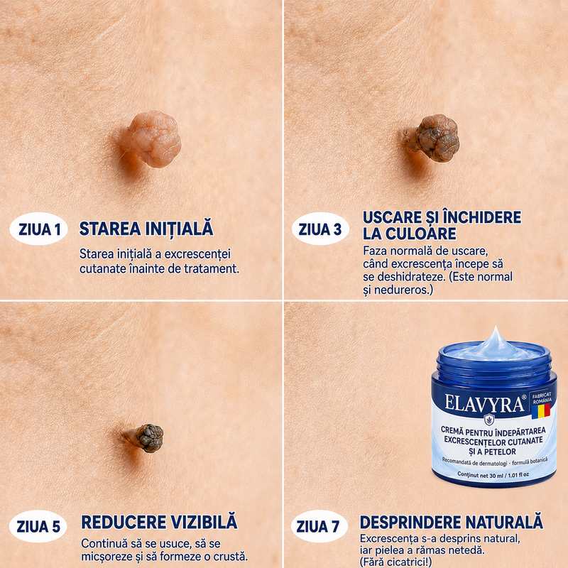 ELAVYRA® cremă pentru îngrijire locală – imagine 4